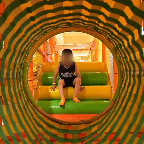 2歲男孩—腦干橋<a href='/naoxueguanliu/' target='_blank'><u>腦海綿狀血管瘤</u></a>