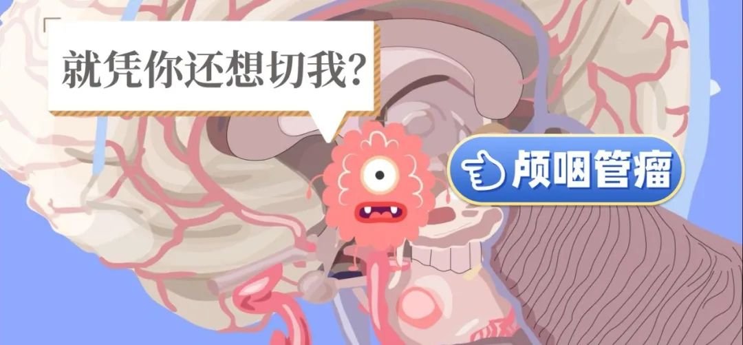 巴教授天壇醫(yī)院顱咽管瘤手術(shù)紀(jì)實(shí)