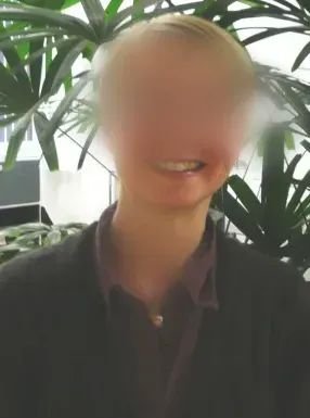 圖：患者功能均很好，無面癱、肢體癱瘓等，工作和生活如常