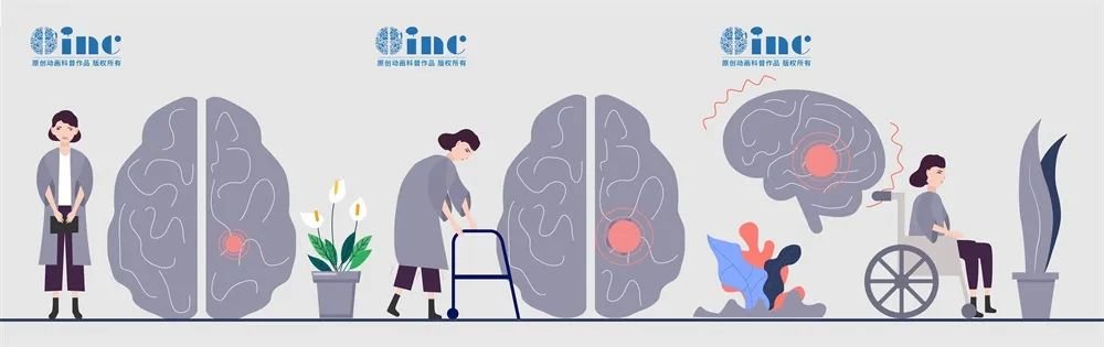 腫瘤就像樹根，生長出無數(shù)的“根須”與神經(jīng)、血管糾纏，尖銳地穿破顱骨，入侵鼻腔、眼眶甚至面部。不僅剝離困難，一旦強行切除，還極有可能損傷重要結(jié)構(gòu)，給患者留下終生遺憾。正因如此，它也比一般的腦膜瘤更易復(fù)發(fā)。