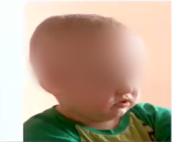＂這孩子沒法手術(shù)＂→視路膠質(zhì)瘤全切！2歲男孩小腦袋里的大戰(zhàn)役