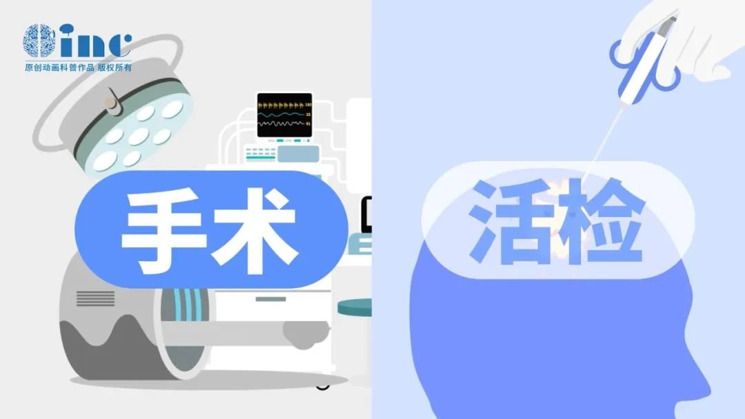 手術還是活檢？