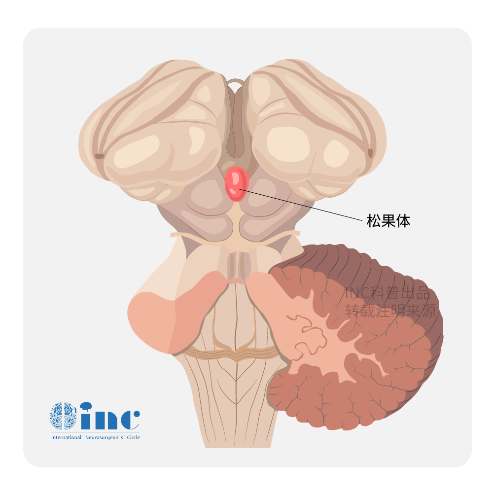 松果體區(qū)位于大腦深部顱腔中心，由松果體及其相鄰結(jié)構(gòu)組成;
