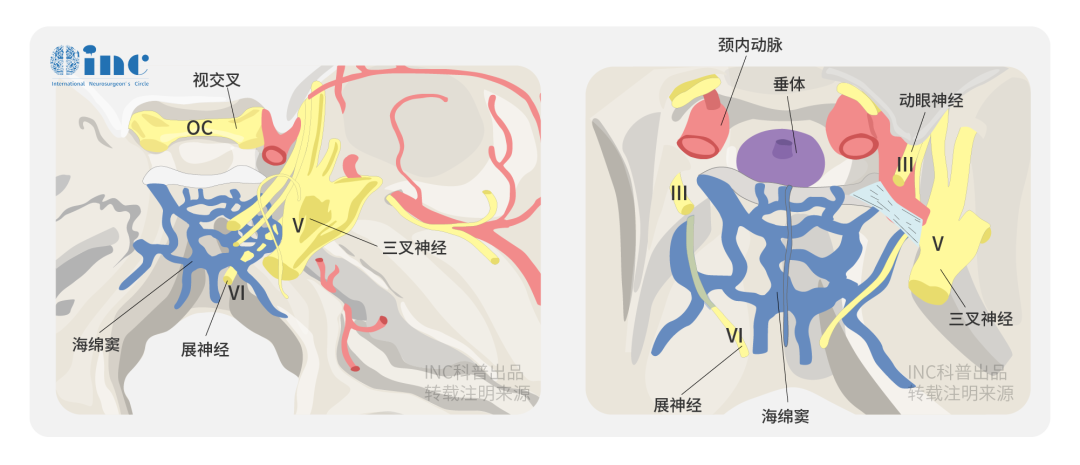 巖斜區(qū)腦膜瘤仍然是神經(jīng)外科醫(yī)生面臨的一個巨大挑戰(zhàn)。