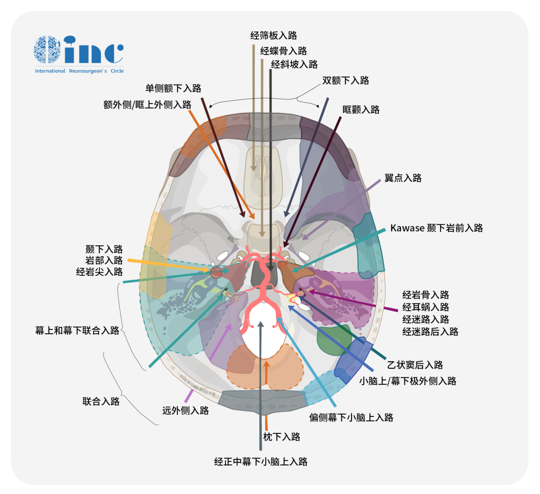 一般情況下，手術(shù)入路的選擇應(yīng)根據(jù)腫瘤的主體范圍、臨床檢查情況、患者年齡以及外科醫(yī)生對所建議手術(shù)入路的習(xí)慣和偏好進(jìn)行選擇。