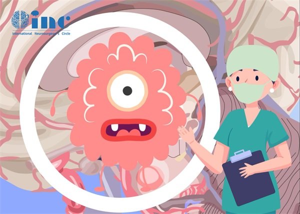 兒童腦動(dòng)靜脈畸形的治療方式