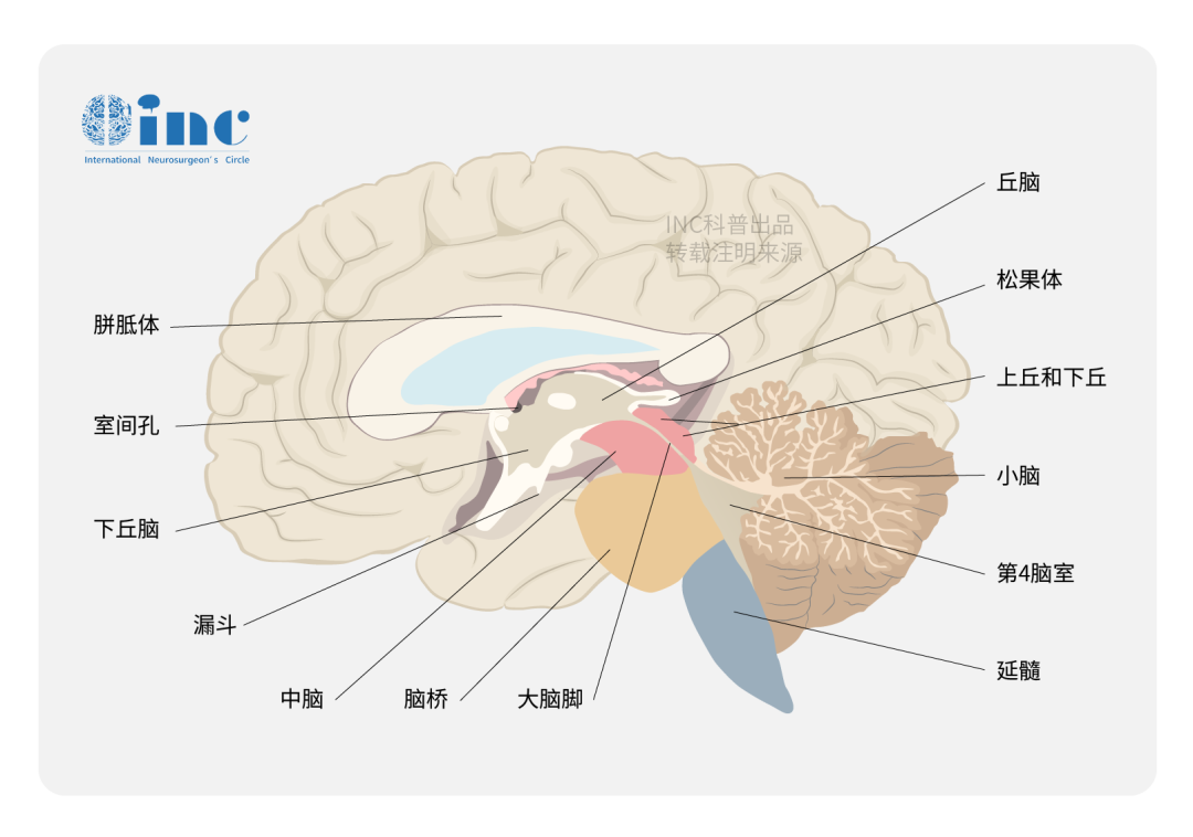 兒童以側(cè)腦室多見，成人則多見于第四腦室。少數(shù)可發(fā)生于橋腦小腦角、鞍上池、鞍區(qū)、腦干、脊髓內(nèi)。
