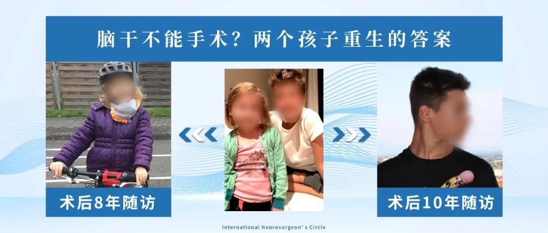 當(dāng)大多數(shù)醫(yī)生對(duì)腦干手術(shù)避之不及時(shí)，INC巴特朗菲教授已成功開展腦干手術(shù)，且患者預(yù)后良好。2014年，兩個(gè)孩子的人生軌跡因腦干膠質(zhì)瘤交織在一起，迎來了命運(yùn)的轉(zhuǎn)折。