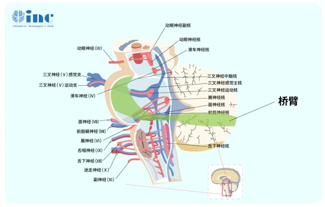 橋臂