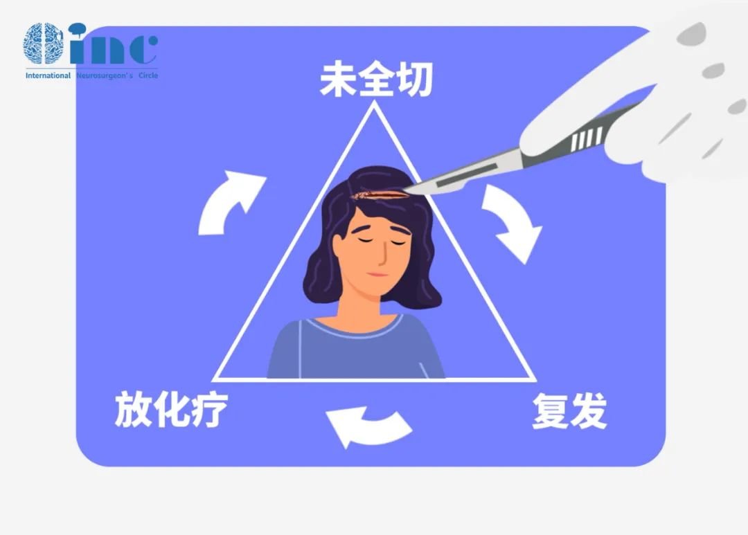 即使顱咽管瘤毗鄰關(guān)系復(fù)雜，完全切除手術(shù)難度大、創(chuàng)傷大、并發(fā)癥發(fā)生率高，手術(shù)仍是顱咽管瘤主要的治療手段，在充分保護(hù)垂體–下丘腦功能及視路結(jié)構(gòu)的前提下積極追求全切除，是保證患者長(zhǎng)期生存的基礎(chǔ)。