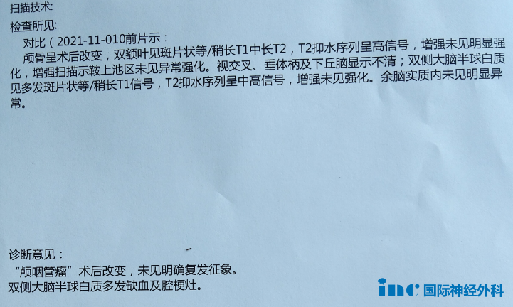 期間隨訪檢查報(bào)告：顯示未復(fù)發(fā)