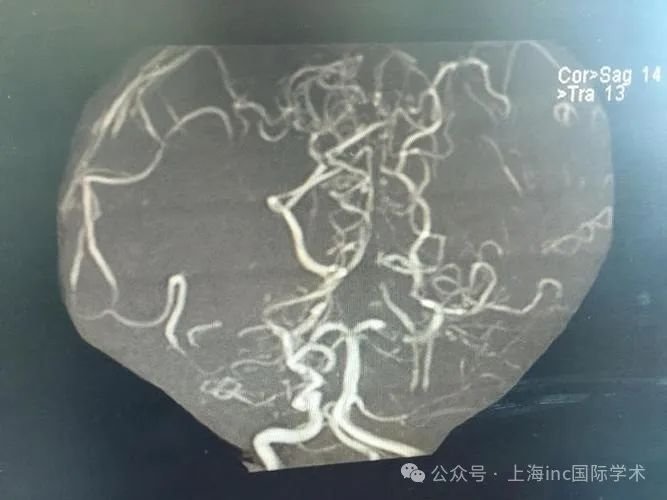 環(huán)境和病理生理因素