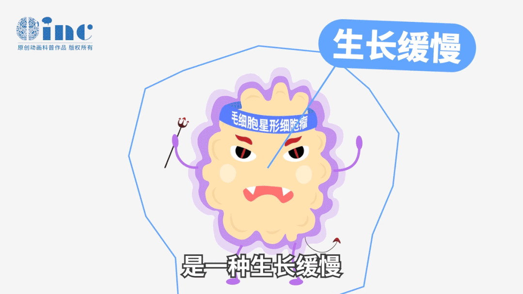 毛細(xì)胞型星形細(xì)胞瘤