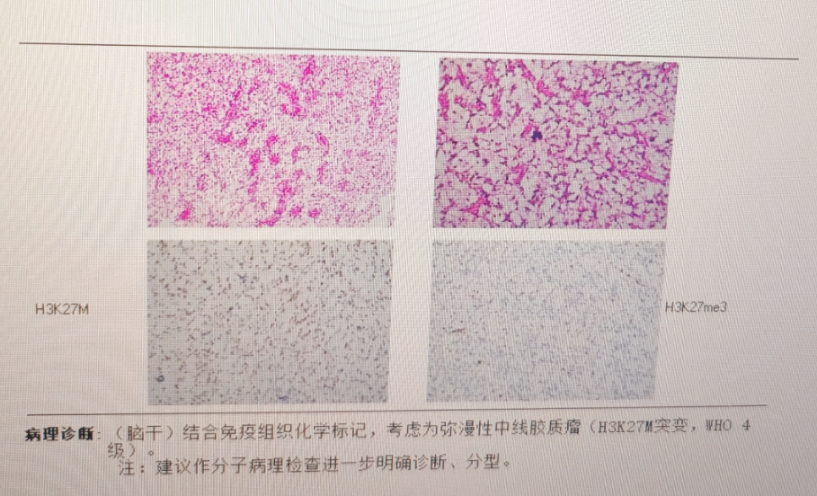病理診斷