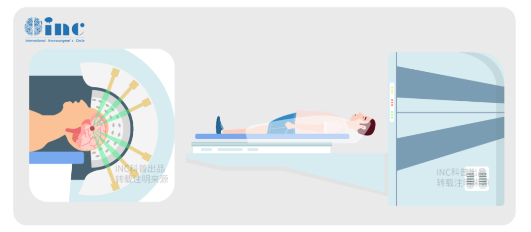 若選擇放療，在規(guī)劃靶區(qū)(局部還是全腦全脊髓照射)和放療劑量時應(yīng)考慮腫瘤的位置、分期、亞型、可能的擴(kuò)散方式、有無有效化療，以及患兒年齡。