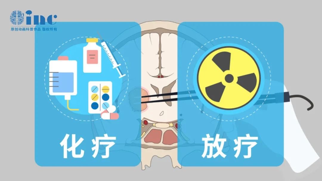 近期研究表明較早的放療對患者的總生存率無明顯影響，而接受放療時間越早，對患兒認(rèn)知、生長發(fā)育及生育能力的影響越大。