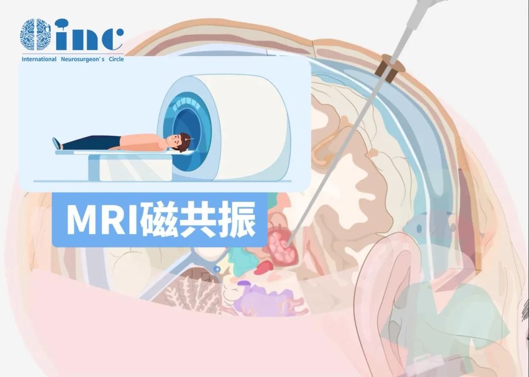 磁共振成像(MRI)是影像學(xué)診斷和評(píng)估的首選方法。
