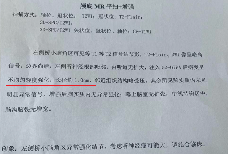 聽(tīng)神經(jīng)瘤疑云背后竟是虛驚一