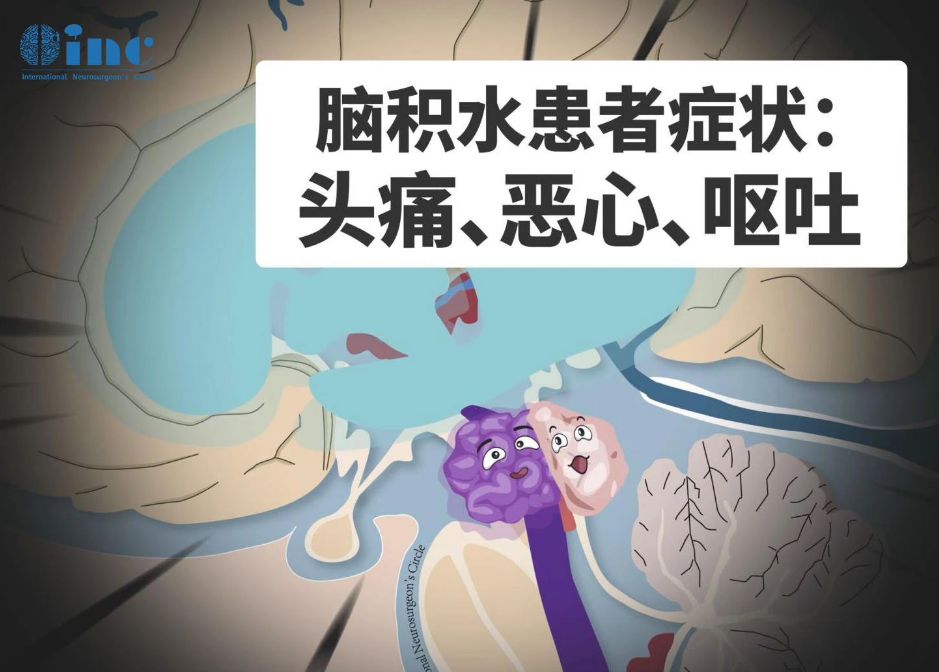 腦積水患者癥狀：頭痛、惡心、嘔吐