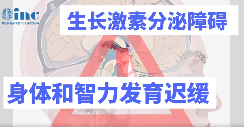顱咽管瘤影響發(fā)育