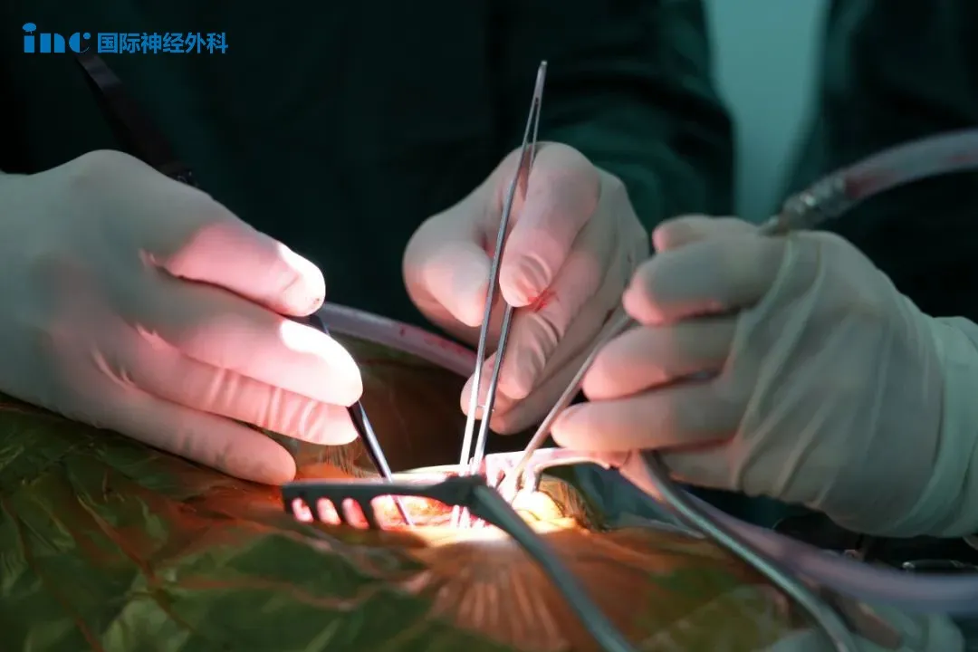 尖端不足0.5mm的手術器械