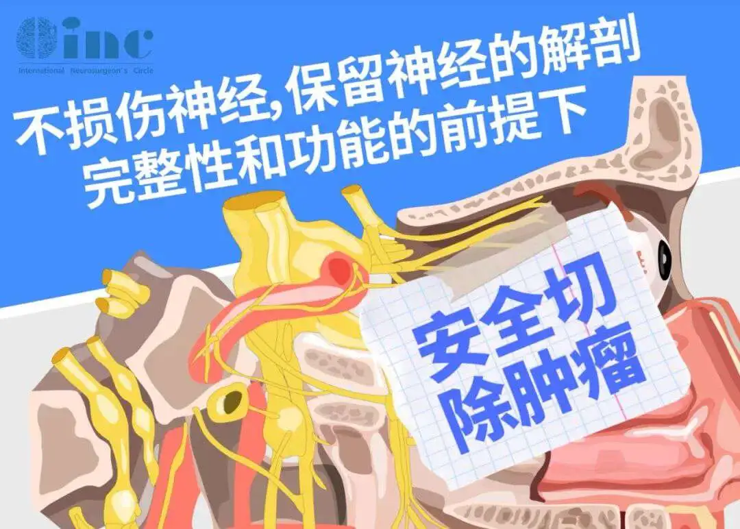 聽神經(jīng)瘤若不治療，會(huì)引發(fā)哪些嚴(yán)重后果？