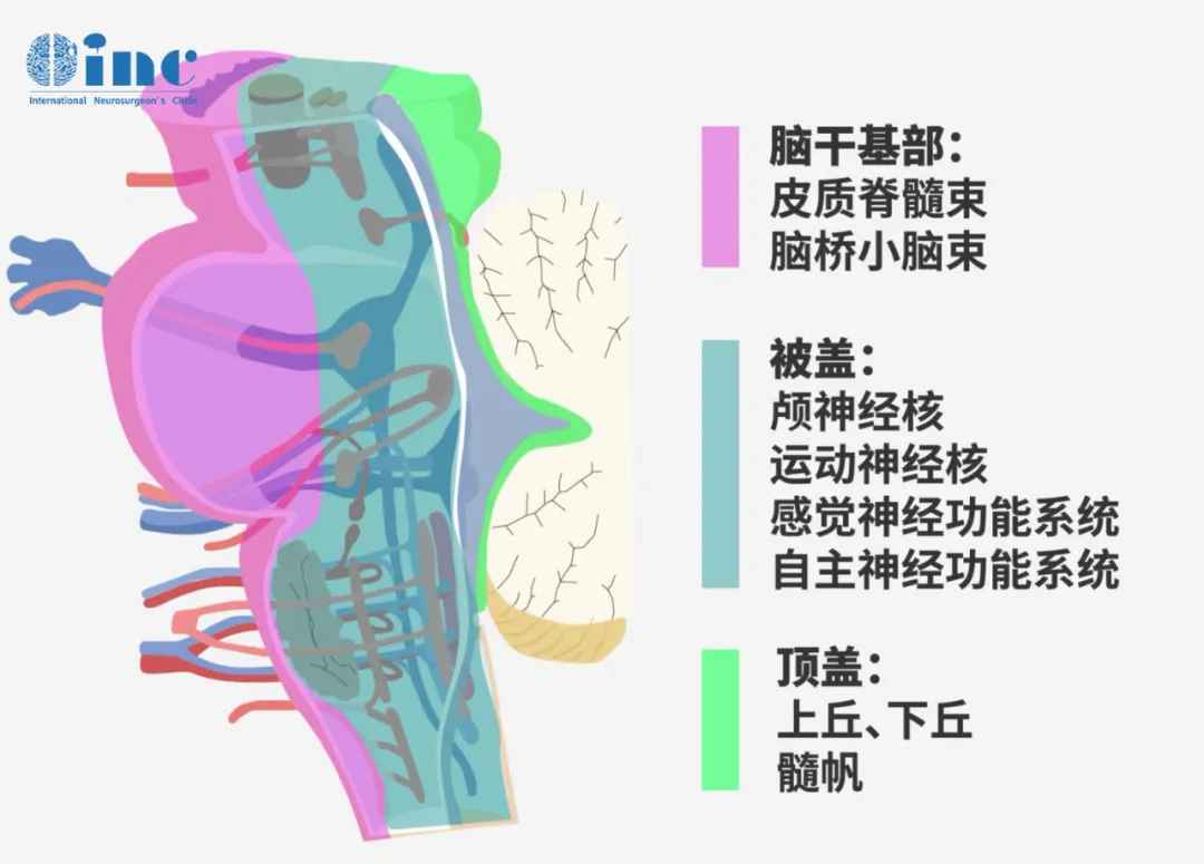 治療局灶性腦干膠質(zhì)瘤需考慮腫瘤的解剖位置，這決定了癥狀及能否手術(shù)切除。腦干低級別膠質(zhì)瘤患者的遠期預(yù)后極佳。
