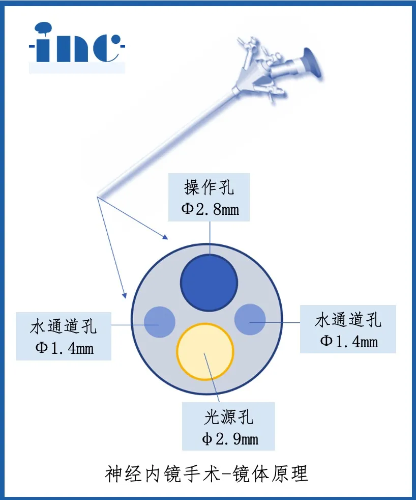 神經(jīng)內(nèi)鏡手術(shù)-鏡體原理