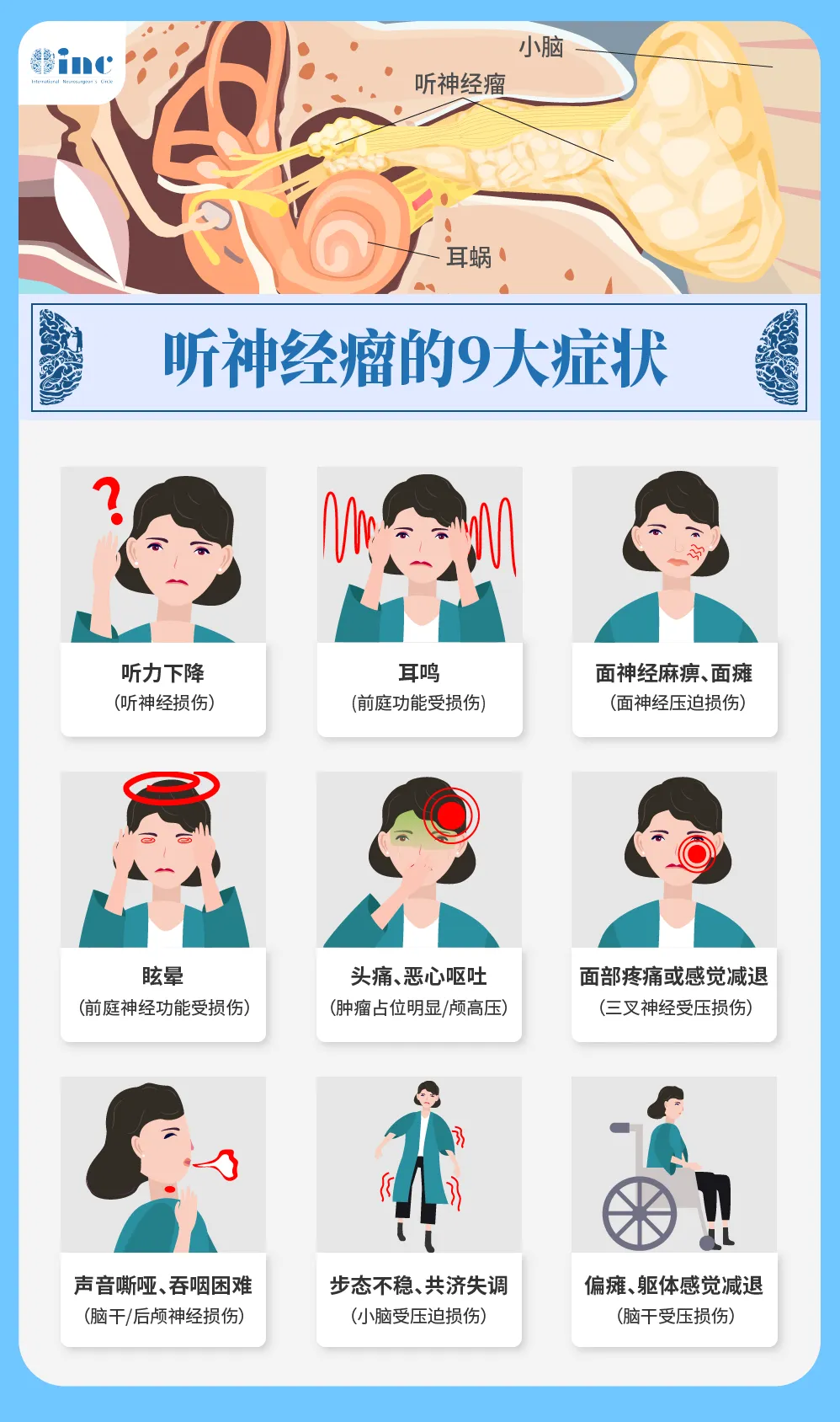 聽(tīng)神經(jīng)瘤9大癥狀