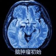 永不停歇的生存欲望，正是腫瘤可怕的力量