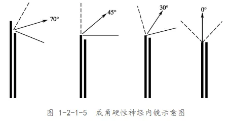 成角硬性神經(jīng)內(nèi)鏡示意圖